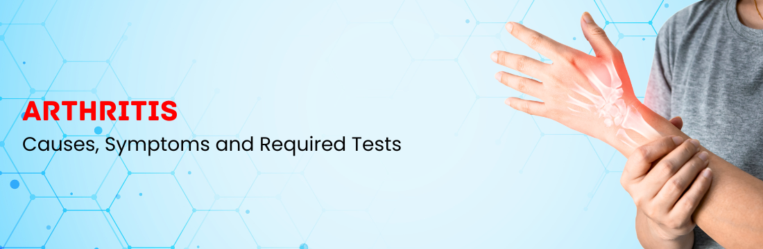 What are the Causes, Symptoms and Tests Required for Arthritis?